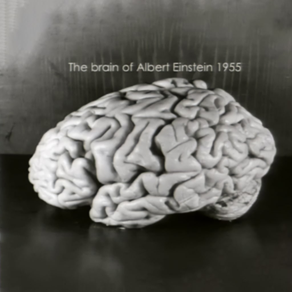 مغز اینشتین